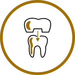 CEREC | Chairside Economical Restoration of Esthetic Ceramics