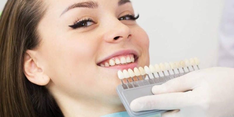 veneers-cost-in-sussex-west Infographic detailing the average prices of veneers in Sussex West, including factors influencing costs and treatment options.