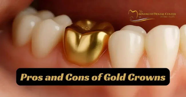 Close-up of teeth with a gold dental crown, overlaid with the text "Pros and Cons of Gold Crowns," highlighting the key pros and cons of gold crowns, with a dental center logo in the background.