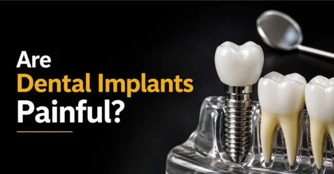 are dental implants painful