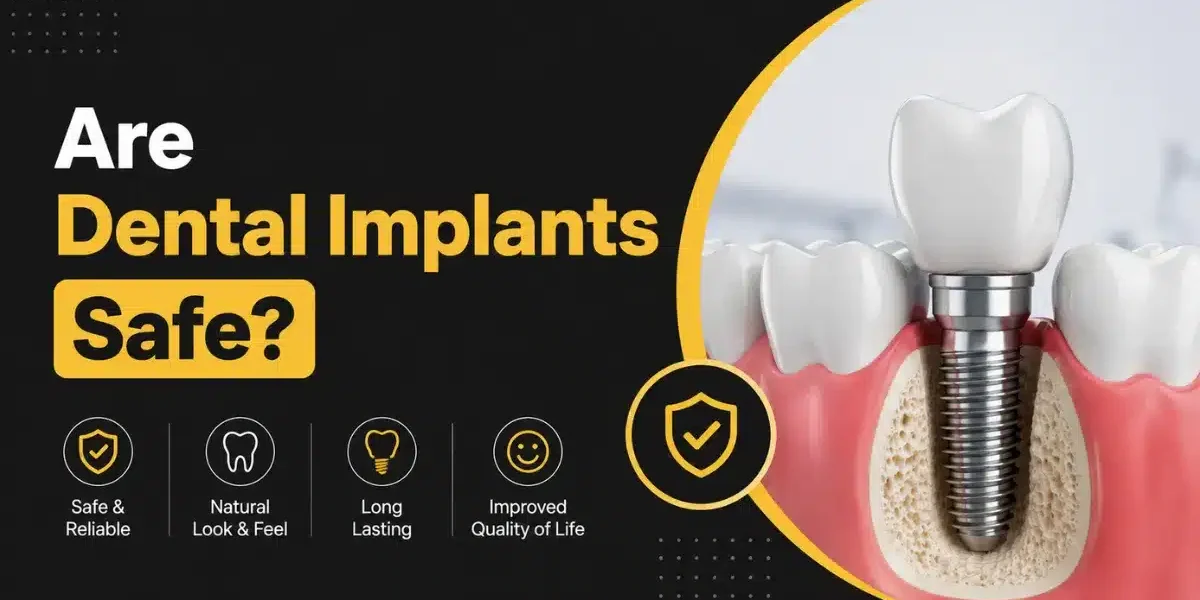 are dental implants safe