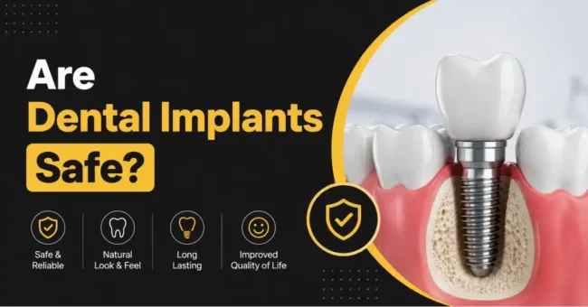 are dental implants safe