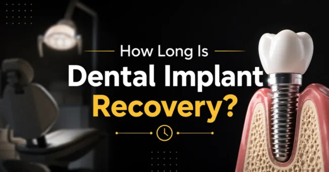 dental implant recovery time