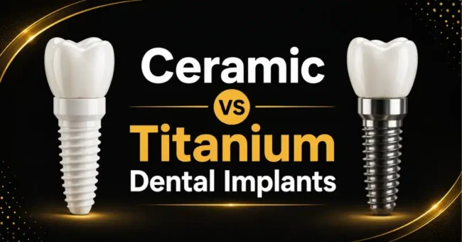ceramic dental implants
