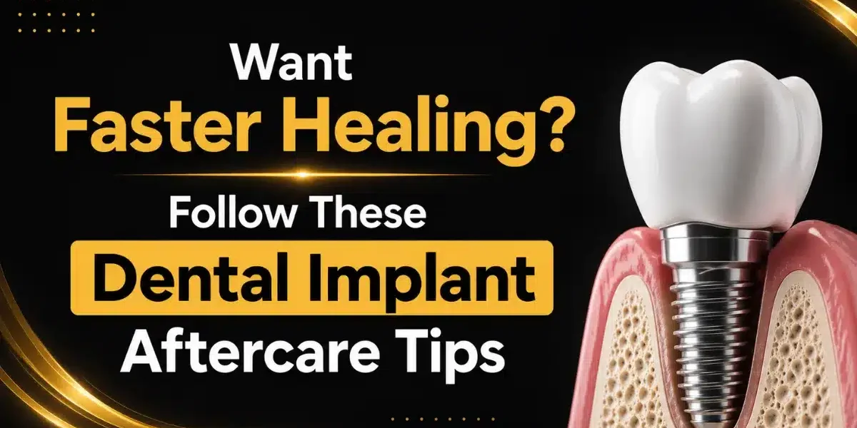 dental implant aftercare