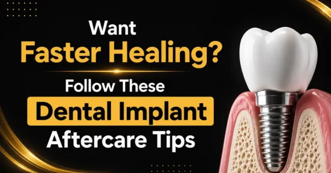 dental implant aftercare