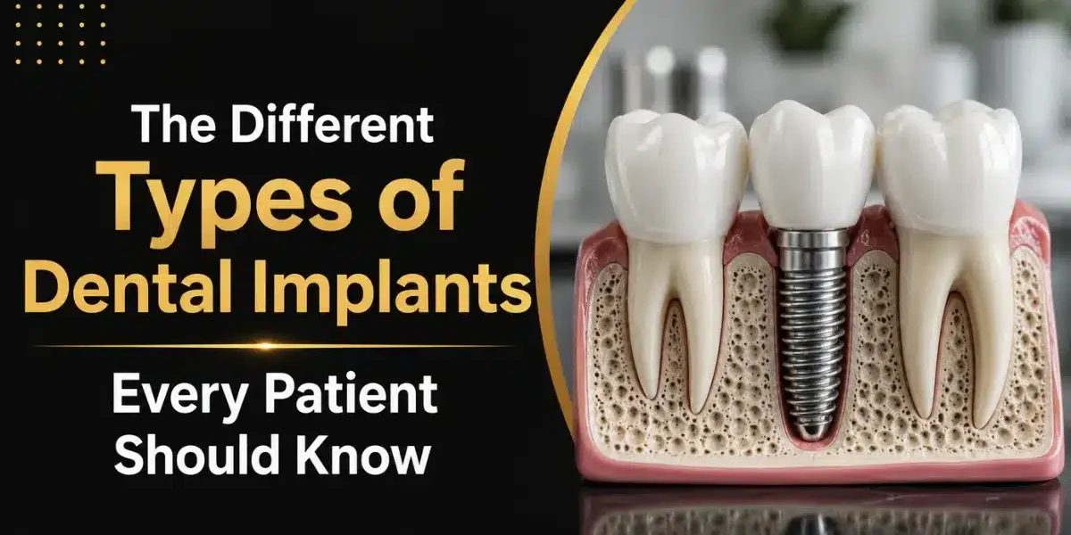 different types of dental implants