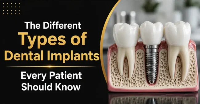 different types of dental implants