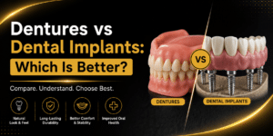 dentures vs dental implants