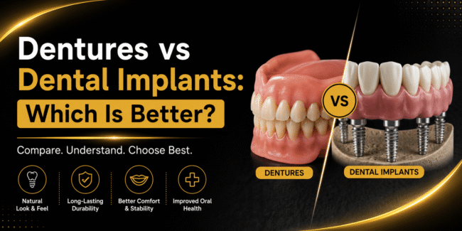 Dental Implants vs Dentures: Which Is Better dentures vs dental implants