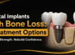 Dental Implants with Bone Loss: Treatment Options