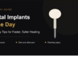 Recovery After Dental Implants Same Day: Tips for Faster Healing