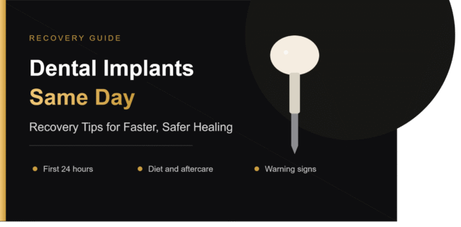 Recovery After Dental Implants Same Day: Tips for Faster Healing Recovery After Dental Implants Same Day: Tips for Faster Healing